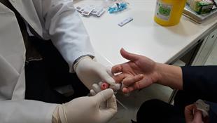HIV Rapid Test
