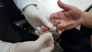 HIV Rapid Test