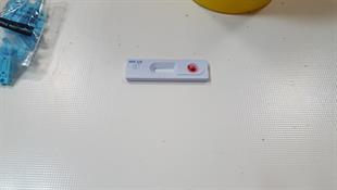 HIV Rapid Test